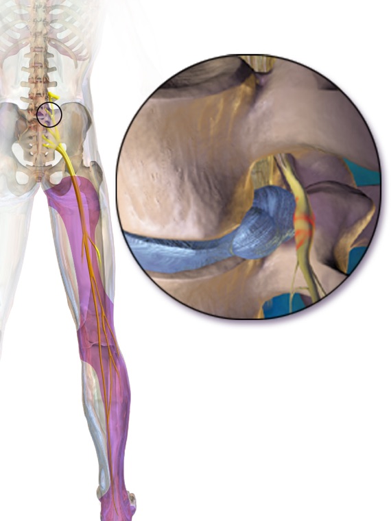 Sciatic nerve path from lower back down the leg